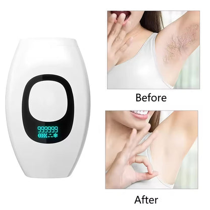 Women's IPL Laser Hair Removal Device for Body and Face